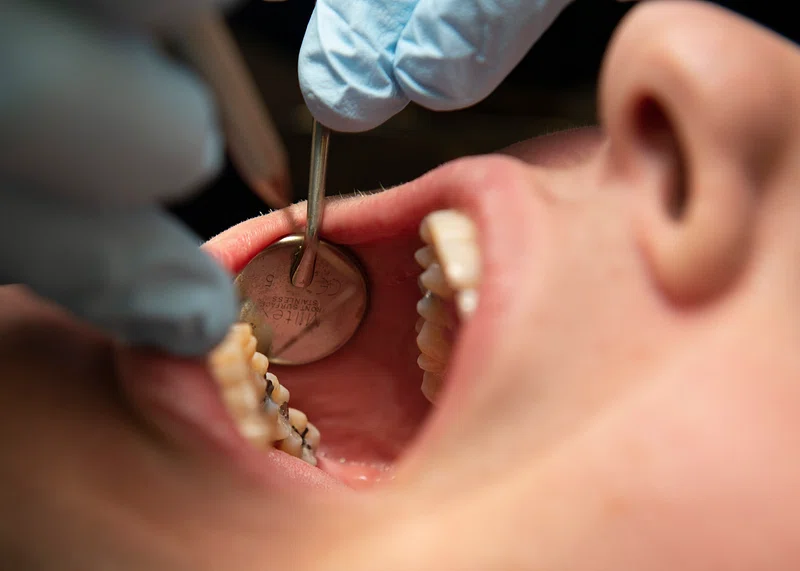 The Best Dentists in Campbell for Exceptional Dental Care